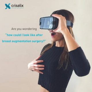 3D-Simulation mit Crisalix zur Brustvergrößerung in Hannover